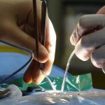 Intricate surgical procedure with surgeons using tools in a sterile operating room.